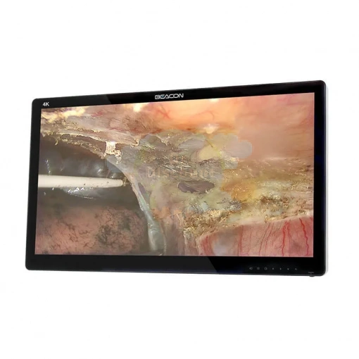 Хирургический монитор сверхвысокой четкости S3282P
